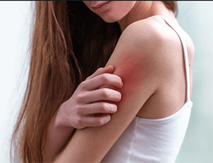 ANTI-ALLERGIC & ANTI-TUSSIVES